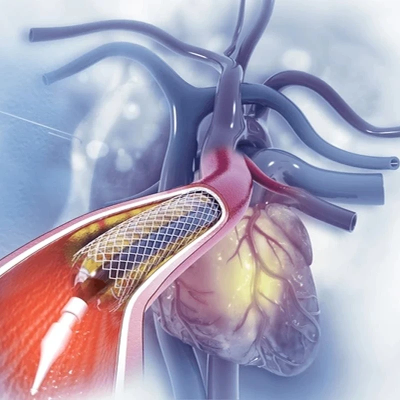 Beating Heart Surgery in mohali